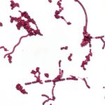 Mixed Smear of Bacteria Types Slide Carbol-Fuchsin by Carolina Supply-0